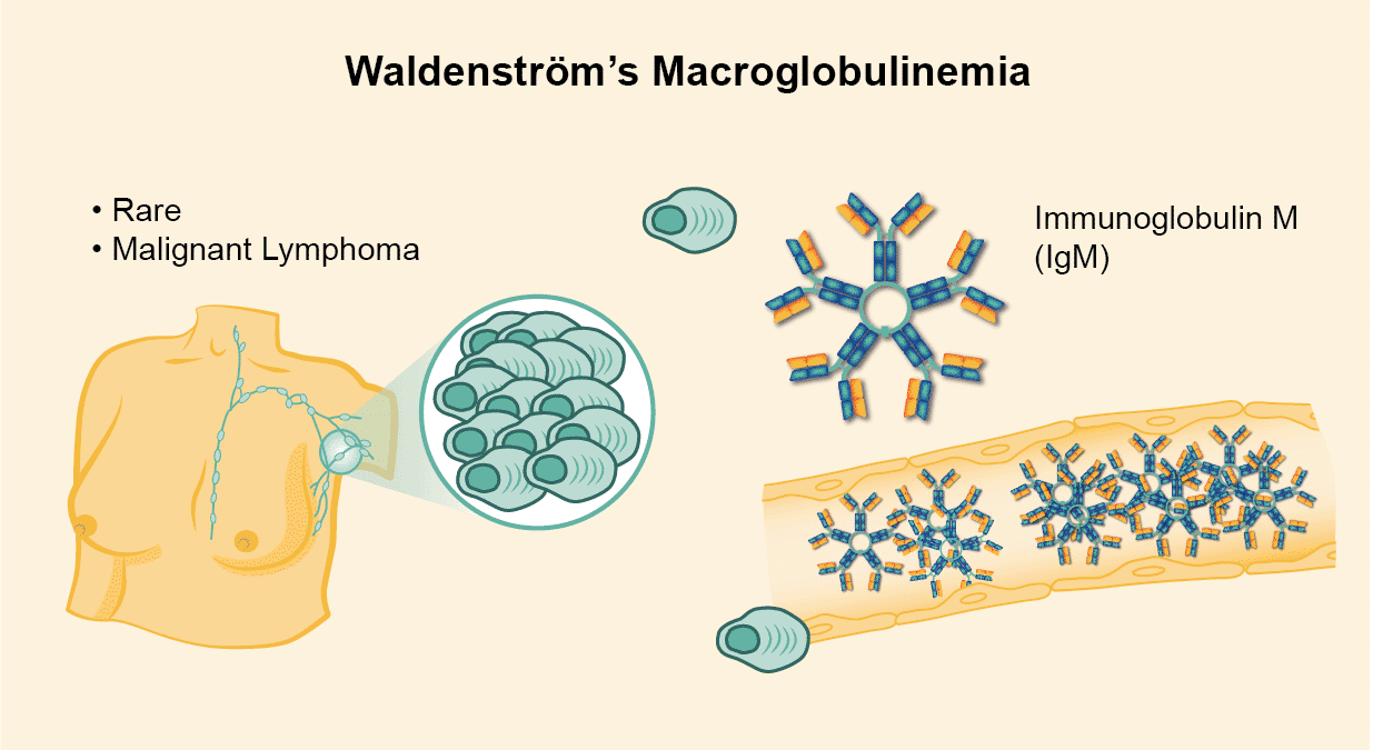 Waldenstrom Syndrom Symptoms